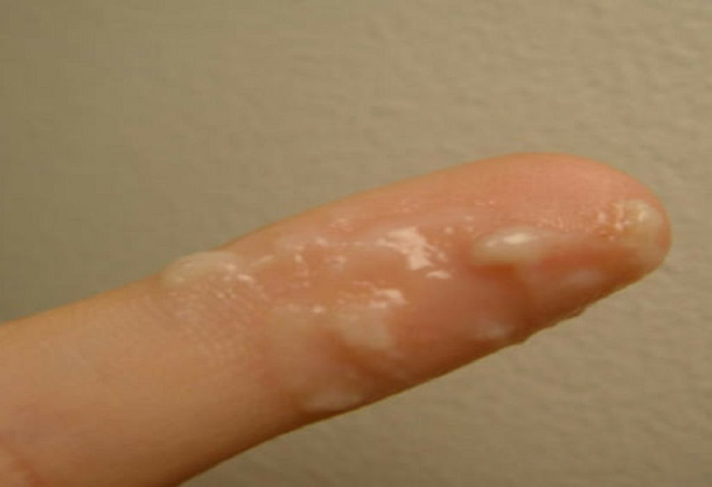 How Does Cervical Mucus Stages Help Predict Fertility?