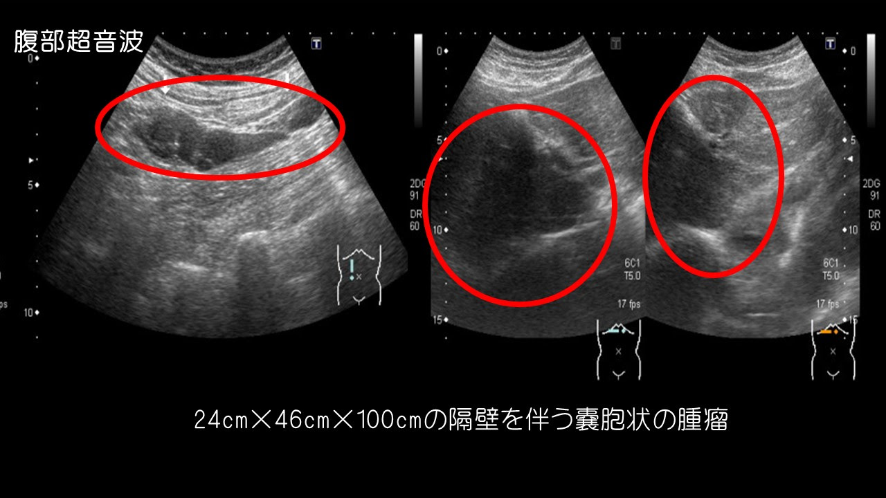 17年8月 幕内 幹男