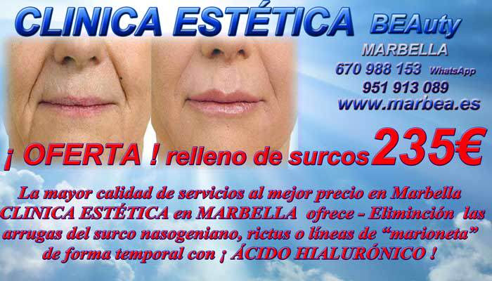 En la CLÍNICA ESTETICA OFRECE LOS MEJOR PRECIO PARA RELLENO DE SURCOS EN MARBELLA y ELIMINACIÓN DE SURCOS  NASOGENIANOS EN MARBELLA