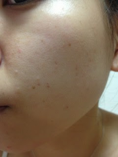 肌変化に感動 新 美容液 エクラフチュール アルビオンの化粧水 美容液 情報 福岡の化粧品販売店まるまんフィオーレがお届け