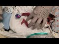 [最も共有された！ √] bébé né à 5 mois de grossesse 503006-Bébé né à 5 mois de grossesse