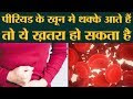 Blood Clot 1 Week Early Pregnancy Implantation Bleeding In Toilet Bowl