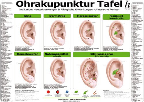 Ohrakupunktur Tafel - Indikation 3869570636 pdf