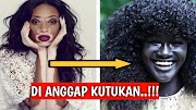 Populer 57+ Jenis Warna Kulit Di Dunia