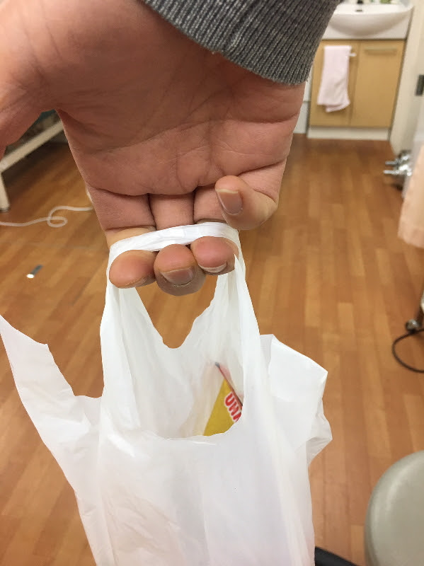 へバーデン結節は治る 痛みと変形 その原因と治療法まで完全解説 はりま接骨院 神戸市西区 明石 はりま接骨院