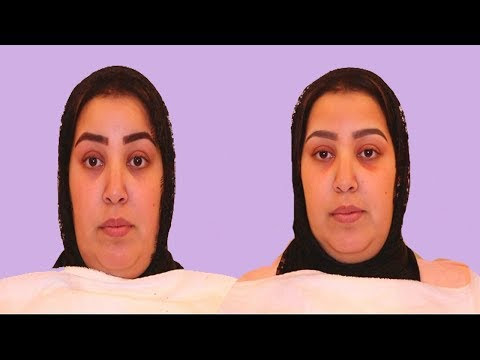 صورة