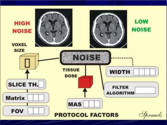 Computed Tomography Image Quality and Dose Management