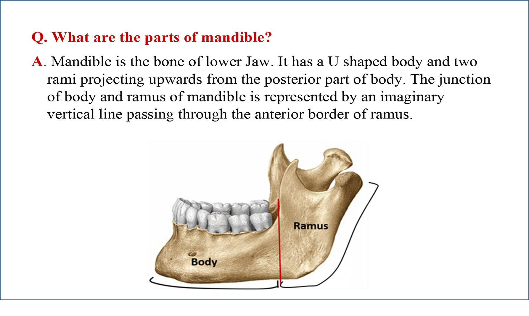 Mandible , Anatomy QA