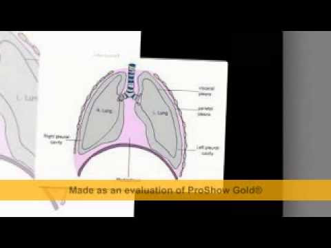 VIDEO : lawyer louisiana mesothelioma - lawyer louisiana mesothelioma. ...