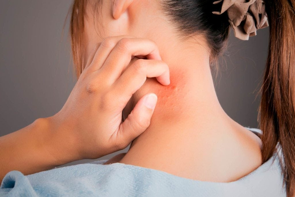 You’ll-Never-Scratch-Your-Mosquito-Bites-Again-Thanks-To-This-New-Gadget