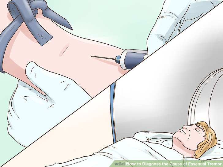 Diagnose the Cause of Essential Tremor Step 7.jpg