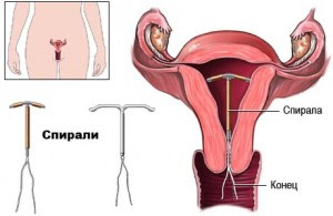 Спирала