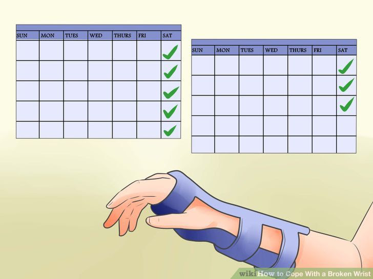 Cope With a Broken Wrist Step 3 Version 2.jpg