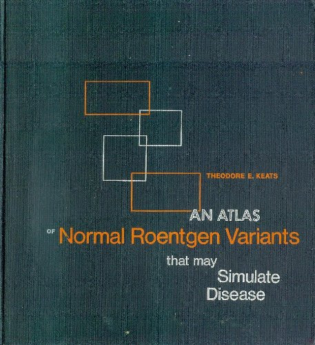 An atlas of normal roentgen variants that may simulate disease, by Theodore E Keats
