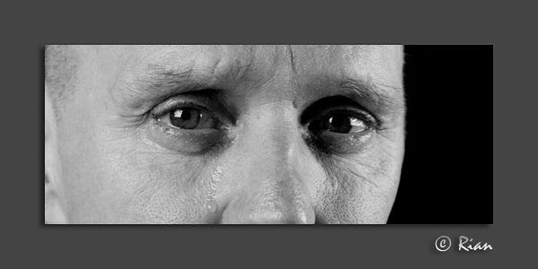 Eyes