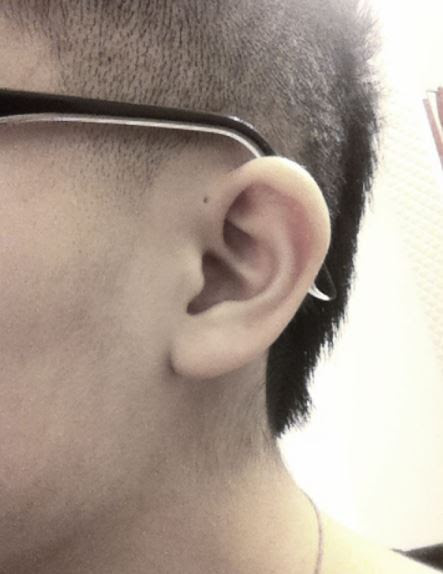 Are You Wondering What That Tiny Extra Hole In Your Ear Is For? You Better Check This Out! 