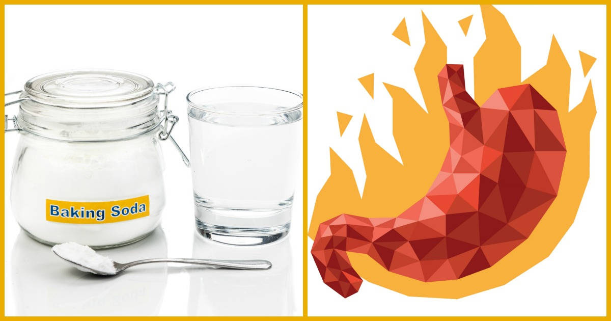 How to Use Baking Soda to Treat and Prevent Acid Reflux