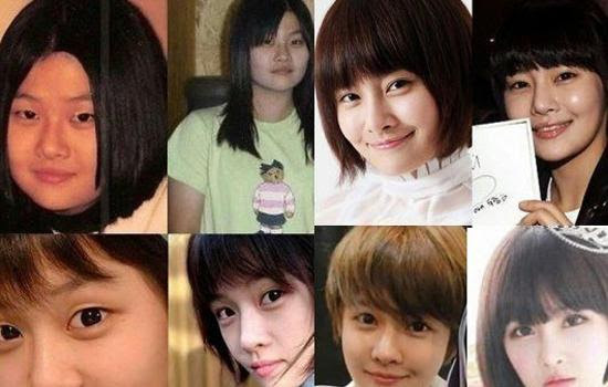 韩国首批整容者集现后遗症女子7年整形1次 中国娱乐资讯网cecet Cn