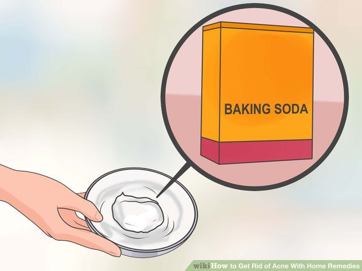 Get Rid of Acne With Home Remedies Step 17.jpg