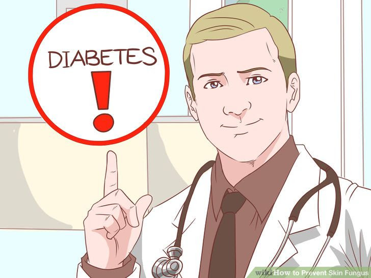 Prevent Skin Fungus Step 19.jpg