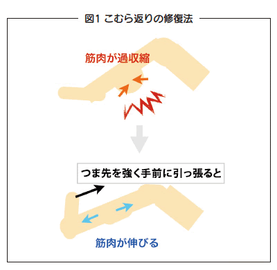 こむら返り