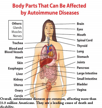 warning signs and symptoms of a stroke acronym