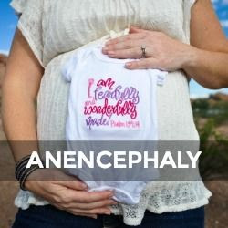  photo anencephaly_zpspbfp5puq.jpg