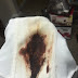 Brown Discharge Pictures Of Spotting During Pregnancy / 5w pregnant: Blood in uterus? (u/s pic) - Page 2 - BabyCenter / Maybe you would like to learn more about one of these?