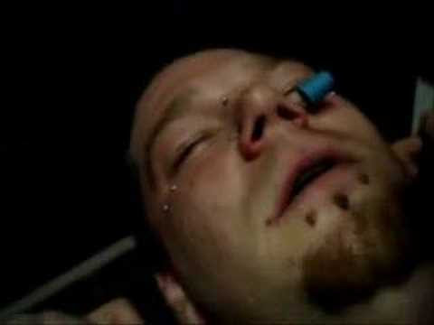 Crazy Nose Piercing. Dec 2, 2007 4:32 AM. The guy in this video has his nose 