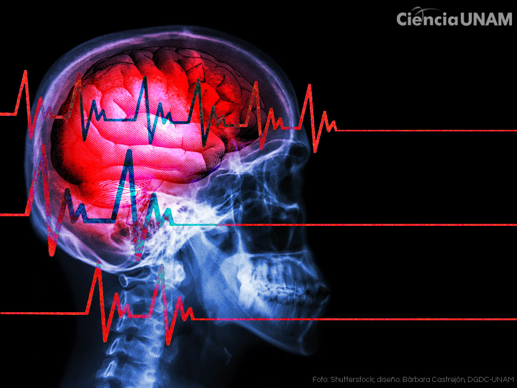 En El Dia De Muertos Muerte Encefalica La Irreversible Perdida De Las Funciones Cerebrales Ciencia Unam