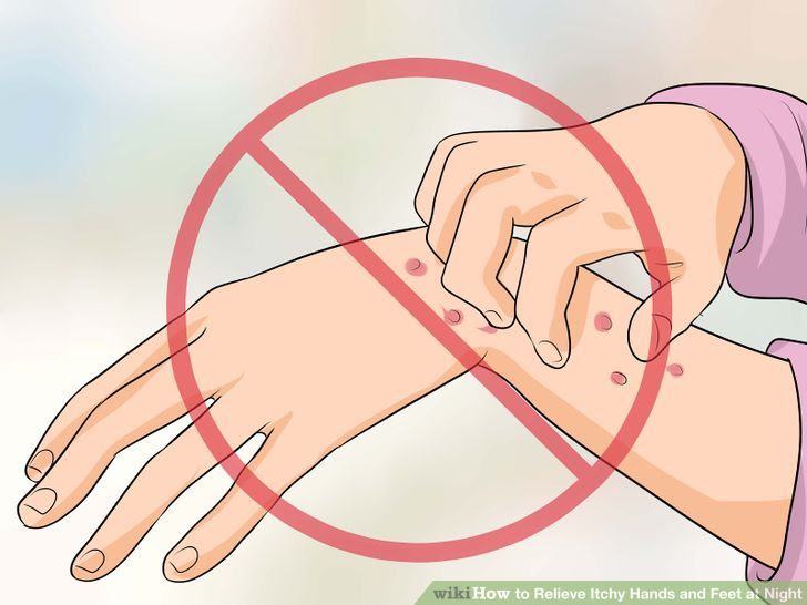 Relieve Itchy Hands and Feet at Night Step 1.jpg