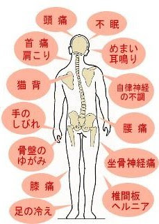 癒しの森やわらぎで頭痛 肩こり 首こり 首痛 腰痛 膝痛 コリ 痛み 歪みを改善