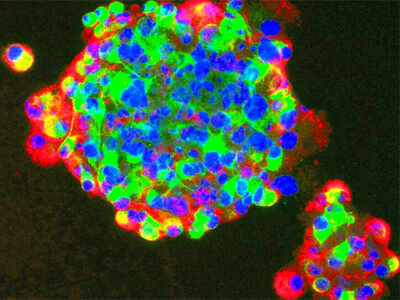umbilical cord resistance