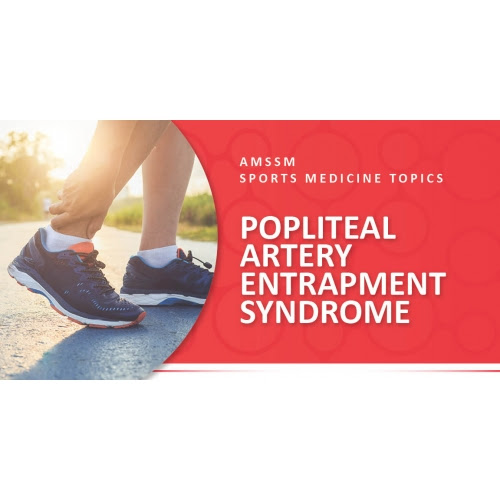 Popliteal Artery Entrapment Syndrome Sports Medicine Today