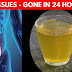 Some Best Healthy Tips For Digestive System