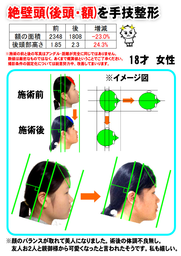 骨格矯正処ムラマサ 整体 カイロプラクティック