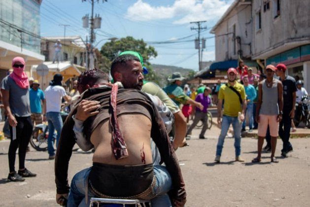 Repression Stands In The Way Of Political Solution To Crisis In Venezuela Inter Press Service