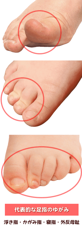 子どもの整足 あかり整体所