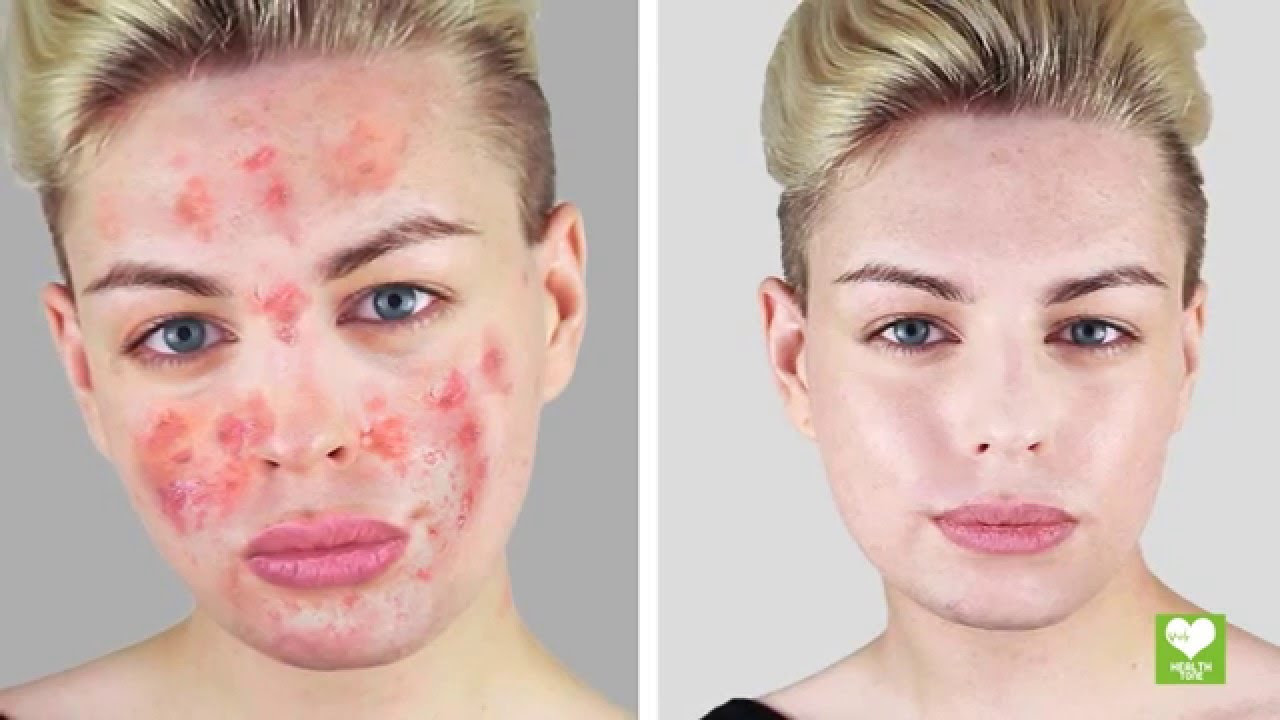 نتيجة بحث الصور عن ‪Multani Mitti skin mask‬‏