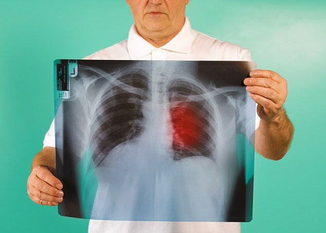 From acid reflux to allergies, we reveal what's causing ...