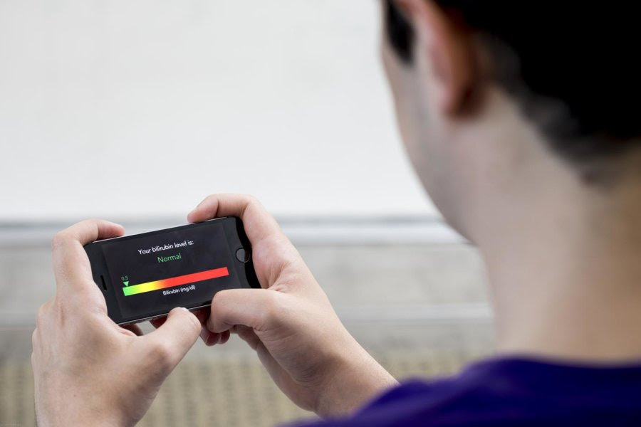 صورة السيلفي في تشخيص السرطان 