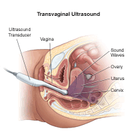 Pelvic Ultrasound
