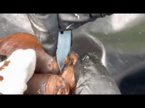 Roseline's packed jiggers - subscribe and watch videos free of charge