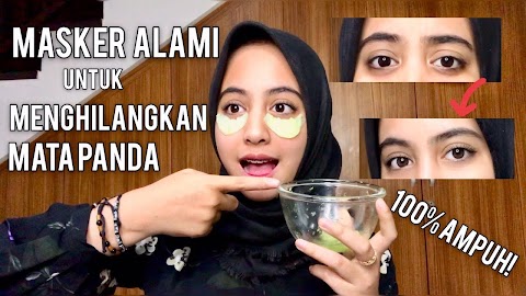 cara menghilangkan jerawat tanpa mata