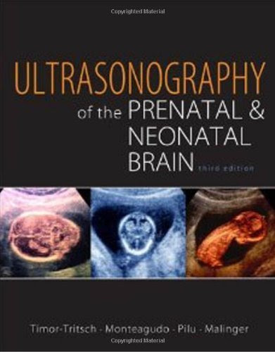 Ultrasonography of the Prenatal Brain, Third Edition