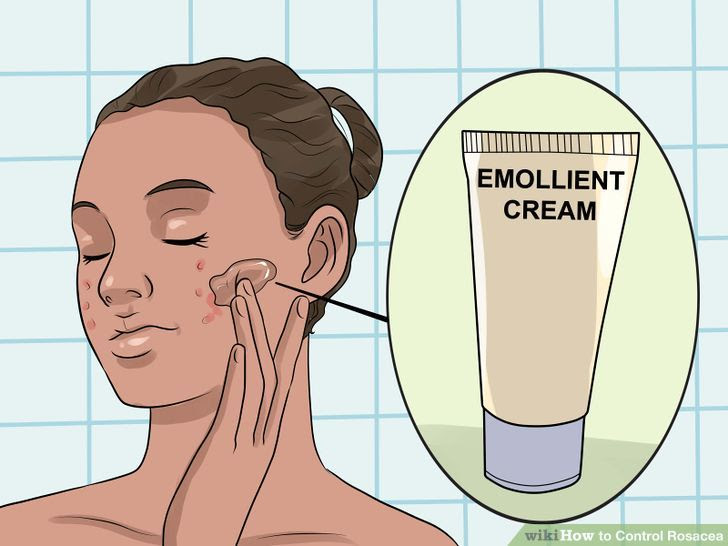 Control Rosacea Step 8 Version 2.jpg