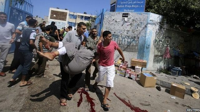 Palestinians carry a wounded man out of a UN-run school in Gaza after an Israeli attack in the area - 3 August 2014