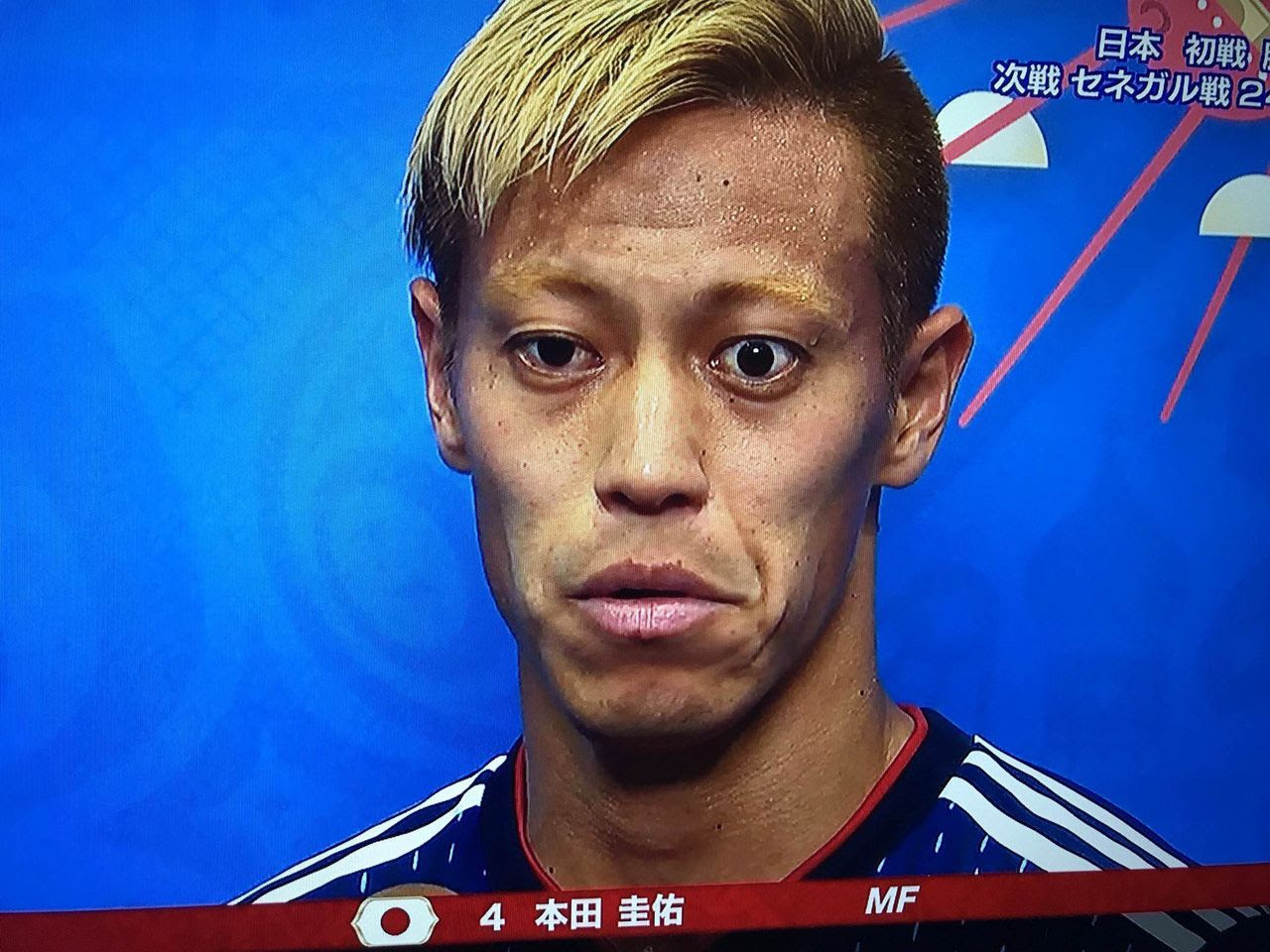 本田圭佑の目がおかしいのは病気で 現在の顔の変化がこちら バセドウ病の手術痕についても