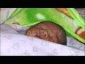 Bayi Baru Lahir Kuning