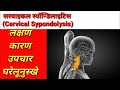 CERVICAL SPONDYLOSIS ( स्पोंडिलोसिस )